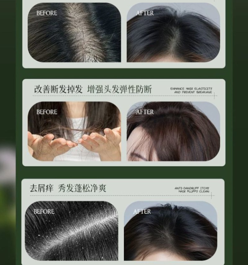 แชมพูสมุนไพรอูสมาน ควบคุมความม - Hair Care Dandruff บทวิจารณ์และราคา